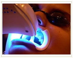 Slider image (6) Dental Retreat